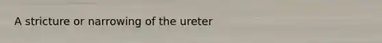 A stricture or narrowing of the ureter