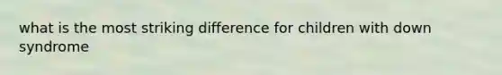 what is the most striking difference for children with down syndrome