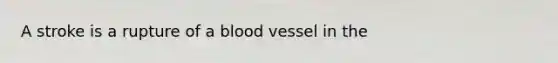 A stroke is a rupture of a blood vessel in the