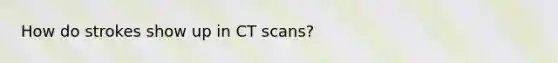 How do strokes show up in CT scans?