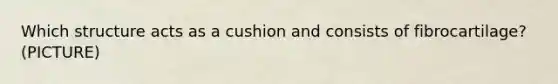 Which structure acts as a cushion and consists of fibrocartilage? (PICTURE)