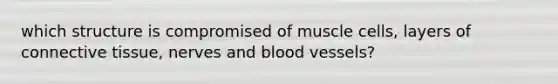 which structure is compromised of muscle cells, layers of connective tissue, nerves and blood vessels?