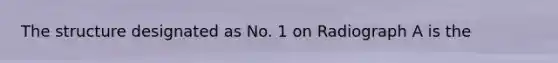 The structure designated as No. 1 on Radiograph A is the