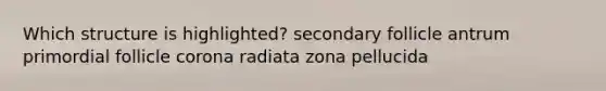 Which structure is highlighted? secondary follicle antrum primordial follicle corona radiata zona pellucida