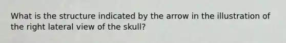 What is the structure indicated by the arrow in the illustration of the right lateral view of the skull?