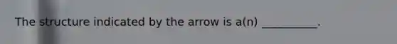 The structure indicated by the arrow is a(n) __________.