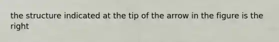 the structure indicated at the tip of the arrow in the figure is the right