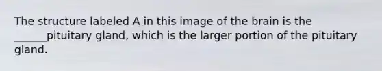 The structure labeled A in this image of the brain is the ______pituitary gland, which is the larger portion of the pituitary gland.