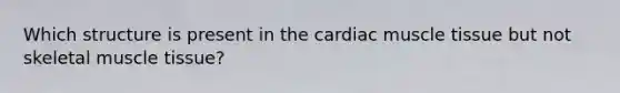 Which structure is present in the cardiac muscle tissue but not skeletal muscle tissue?