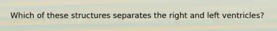 Which of these structures separates the right and left ventricles?