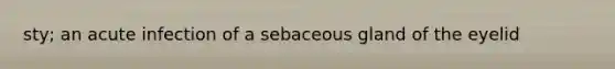 sty; an acute infection of a sebaceous gland of the eyelid