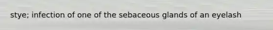 stye; infection of one of the sebaceous glands of an eyelash