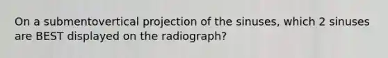 On a submentovertical projection of the sinuses, which 2 sinuses are BEST displayed on the radiograph?