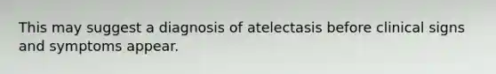 This may suggest a diagnosis of atelectasis before clinical signs and symptoms appear.