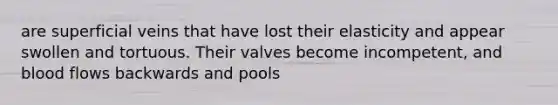 are superficial veins that have lost their elasticity and appear swollen and tortuous. Their valves become incompetent, and blood flows backwards and pools