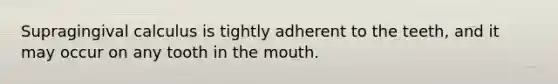 Supragingival calculus is tightly adherent to the teeth, and it may occur on any tooth in the mouth.