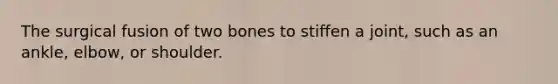 The surgical fusion of two bones to stiffen a joint, such as an ankle, elbow, or shoulder.