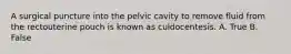 A surgical puncture into the pelvic cavity to remove fluid from the rectouterine pouch is known as culdocentesis. A. True B. False