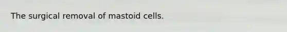 The surgical removal of mastoid cells.