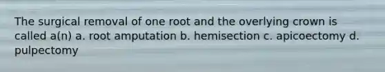 The surgical removal of one root and the overlying crown is called a(n) a. root amputation b. hemisection c. apicoectomy d. pulpectomy