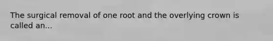 The surgical removal of one root and the overlying crown is called an...