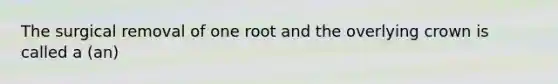 The surgical removal of one root and the overlying crown is called a (an)