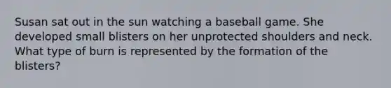 Susan sat out in the sun watching a baseball game. She developed small blisters on her unprotected shoulders and neck. What type of burn is represented by the formation of the blisters?