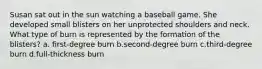 Susan sat out in the sun watching a baseball game. She developed small blisters on her unprotected shoulders and neck. What type of burn is represented by the formation of the blisters? a. first-degree burn b.second-degree burn c.third-degree burn d.full-thickness burn