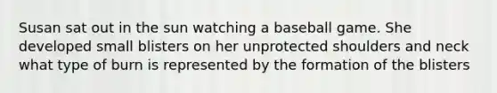 Susan sat out in the sun watching a baseball game. She developed small blisters on her unprotected shoulders and neck what type of burn is represented by the formation of the blisters