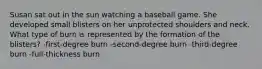 Susan sat out in the sun watching a baseball game. She developed small blisters on her unprotected shoulders and neck. What type of burn is represented by the formation of the blisters? -first-degree burn -second-degree burn -third-degree burn -full-thickness burn