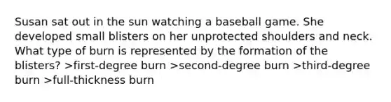 Susan sat out in the sun watching a baseball game. She developed small blisters on her unprotected shoulders and neck. What type of burn is represented by the formation of the blisters? >first-degree burn >second-degree burn >third-degree burn >full-thickness burn