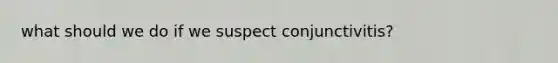 what should we do if we suspect conjunctivitis?