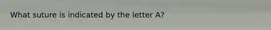 What suture is indicated by the letter A?