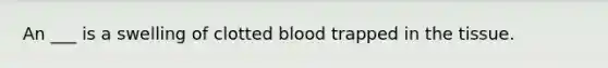 An ___ is a swelling of clotted blood trapped in the tissue.