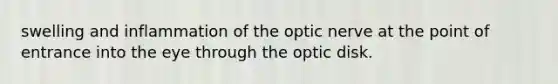 swelling and inflammation of the optic nerve at the point of entrance into the eye through the optic disk.