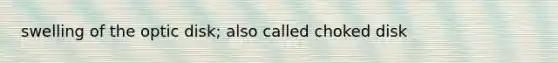 swelling of the optic disk; also called choked disk