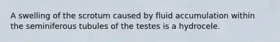 A swelling of the scrotum caused by fluid accumulation within the seminiferous tubules of the testes is a hydrocele.