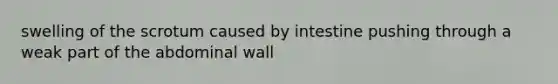 swelling of the scrotum caused by intestine pushing through a weak part of the abdominal wall