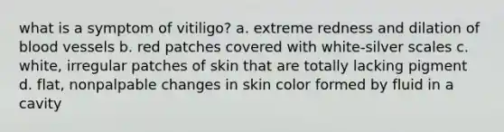 what is a symptom of vitiligo? a. extreme redness and dilation of <a href='https://www.questionai.com/knowledge/kZJ3mNKN7P-blood-vessels' class='anchor-knowledge'>blood vessels</a> b. red patches covered with white-silver scales c. white, irregular patches of skin that are totally lacking pigment d. flat, nonpalpable changes in skin color formed by fluid in a cavity