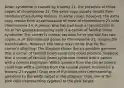 Down syndrome is caused by trisomy 21, the presence of three copies of chromosome 21. The extra copy usually results from nondisjunction during meiosis. In some cases, however, the extra copy results from a translocation of most of chromosome 21 onto chromosome 14. A person who has had such a translocation in his or her gamete-producing cells is a carrier of familial Down syndrome. The carrier is normal because he or she still has two copies of all the essential genes on chromosome 21, despite the translocation. However, the same may not be true for the carrier's offspring. The diagram shows the six possible gametes that a carrier of familial Down syndrome could produce. Suppose that a carrier of familial Down syndrome mated with a person with a normal karyotype. Which gamete from the carrier parent could fuse with a gamete from the normal parent to produce a trisomy-21 zygote? Drag one of the white cells (representing gametes) to the white target in the diagram. Drag one of the pink cells (representing zygotes) to the pink target.