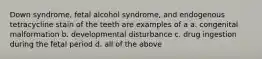 Down syndrome, fetal alcohol syndrome, and endogenous tetracycline stain of the teeth are examples of a a. congenital malformation b. developmental disturbance c. drug ingestion during the fetal period d. all of the above