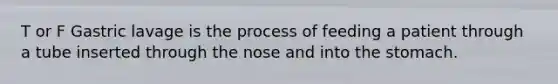 T or F Gastric lavage is the process of feeding a patient through a tube inserted through the nose and into the stomach.