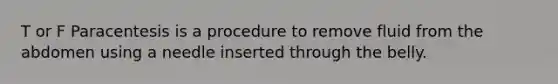 T or F Paracentesis is a procedure to remove fluid from the abdomen using a needle inserted through the belly.