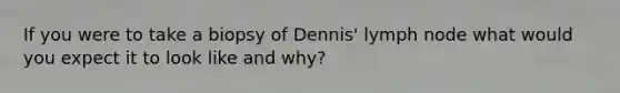 If you were to take a biopsy of Dennis' lymph node what would you expect it to look like and why?