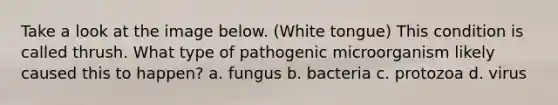 Take a look at the image below. (White tongue) This condition is called thrush. What type of pathogenic microorganism likely caused this to happen? a. fungus b. bacteria c. protozoa d. virus