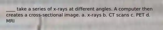 ____ take a series of x-rays at different angles. A computer then creates a cross-sectional image. a. x-rays b. CT scans c. PET d. MRI