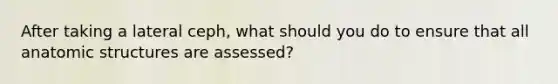 After taking a lateral ceph, what should you do to ensure that all anatomic structures are assessed?