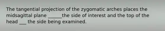 The tangential projection of the zygomatic arches places the midsagittal plane ______the side of interest and the top of the head ___ the side being examined.