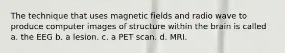 The technique that uses magnetic fields and radio wave to produce computer images of structure within the brain is called a. the EEG b. a lesion. c. a PET scan. d. MRI.