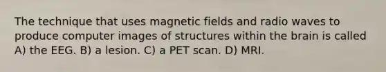 The technique that uses magnetic fields and radio waves to produce computer images of structures within the brain is called A) the EEG. B) a lesion. C) a PET scan. D) MRI.